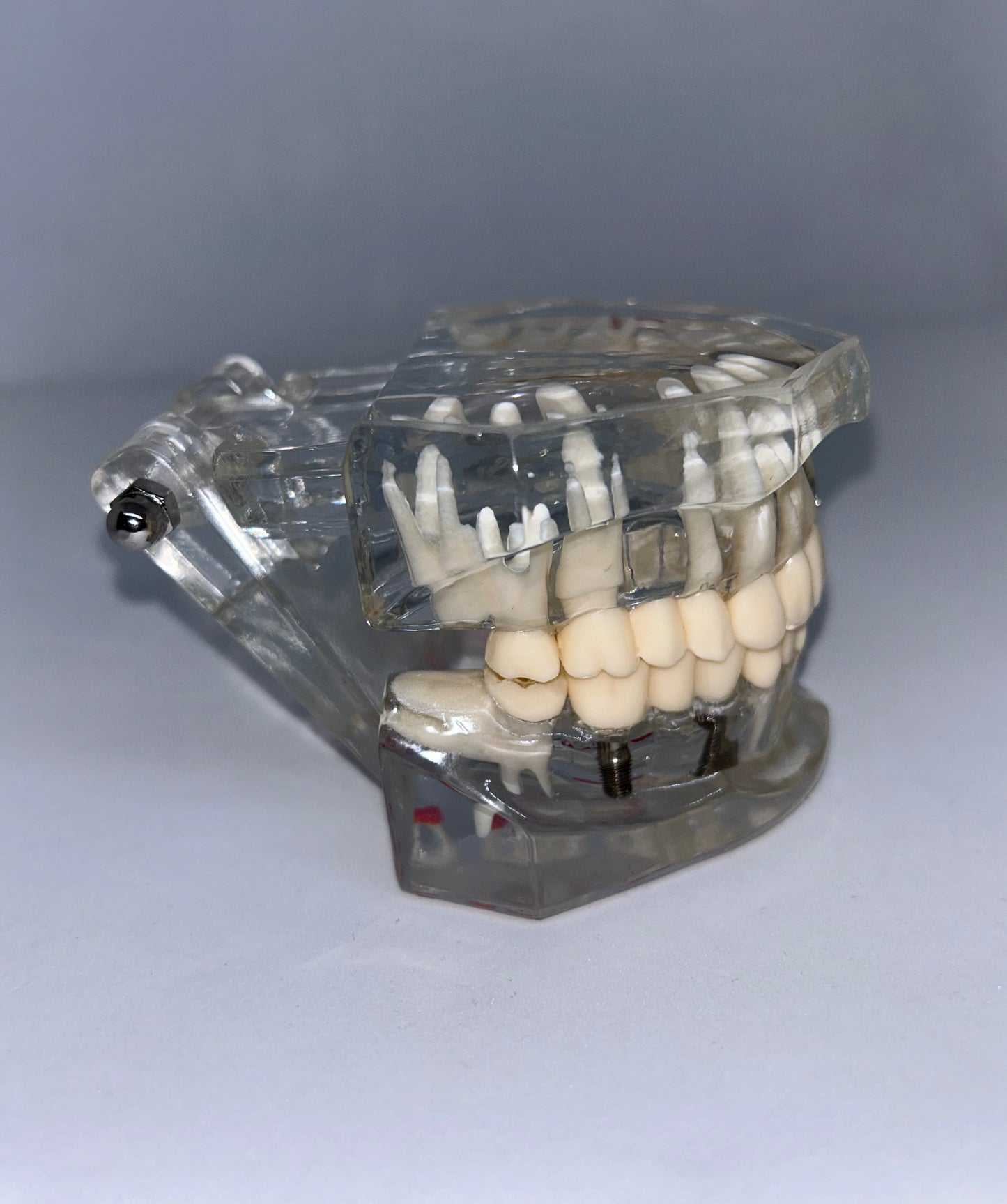 Implant model