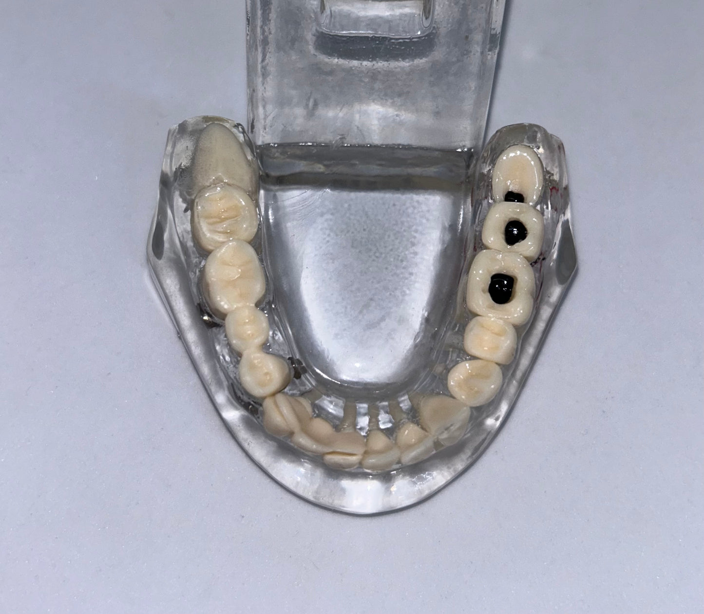 Implant model