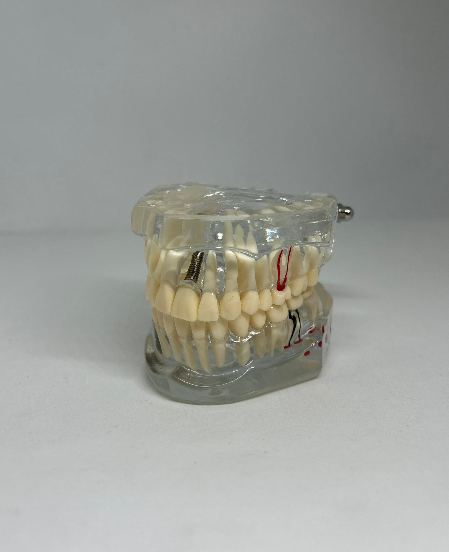 Implant model
