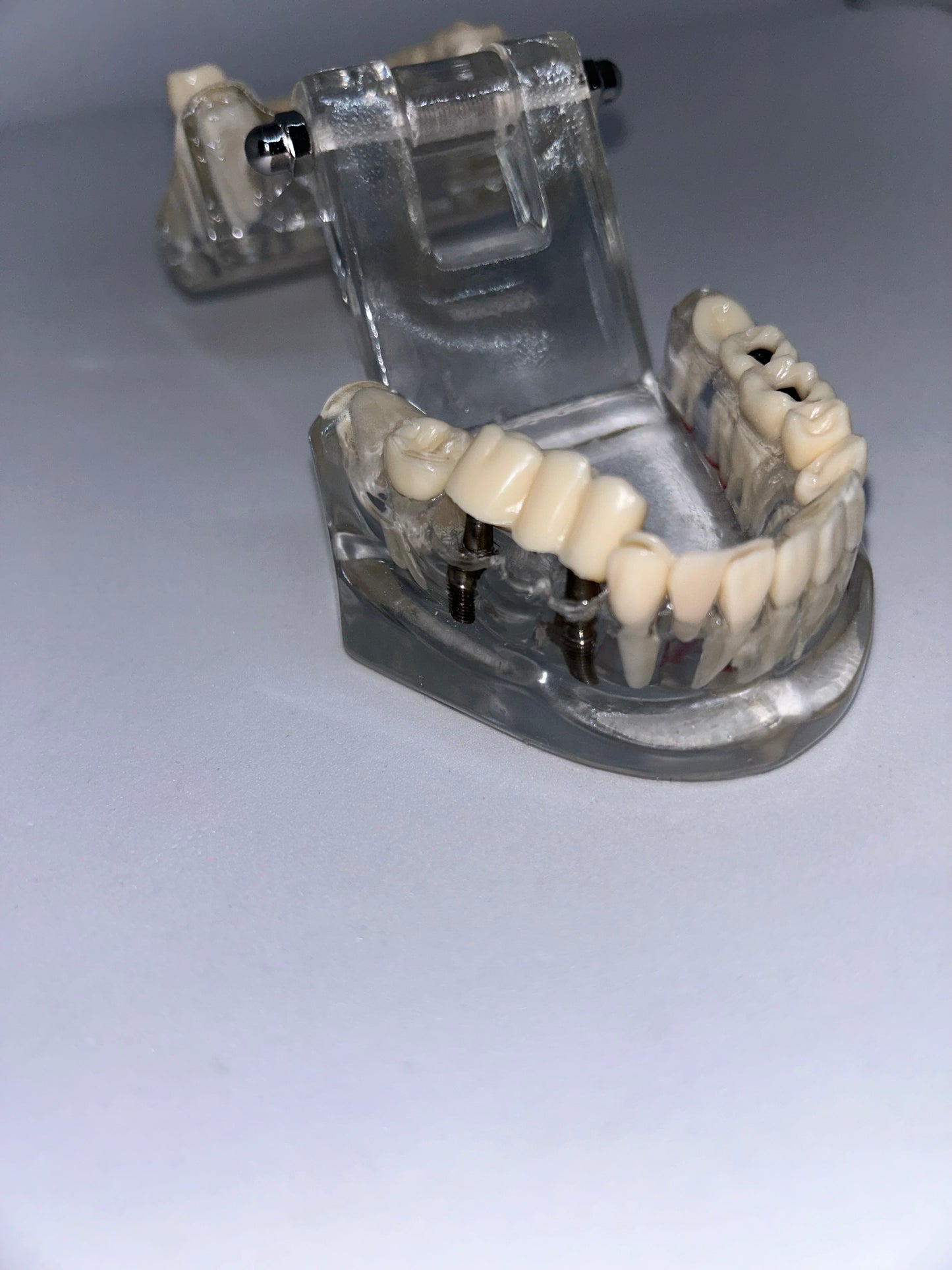 Implant model