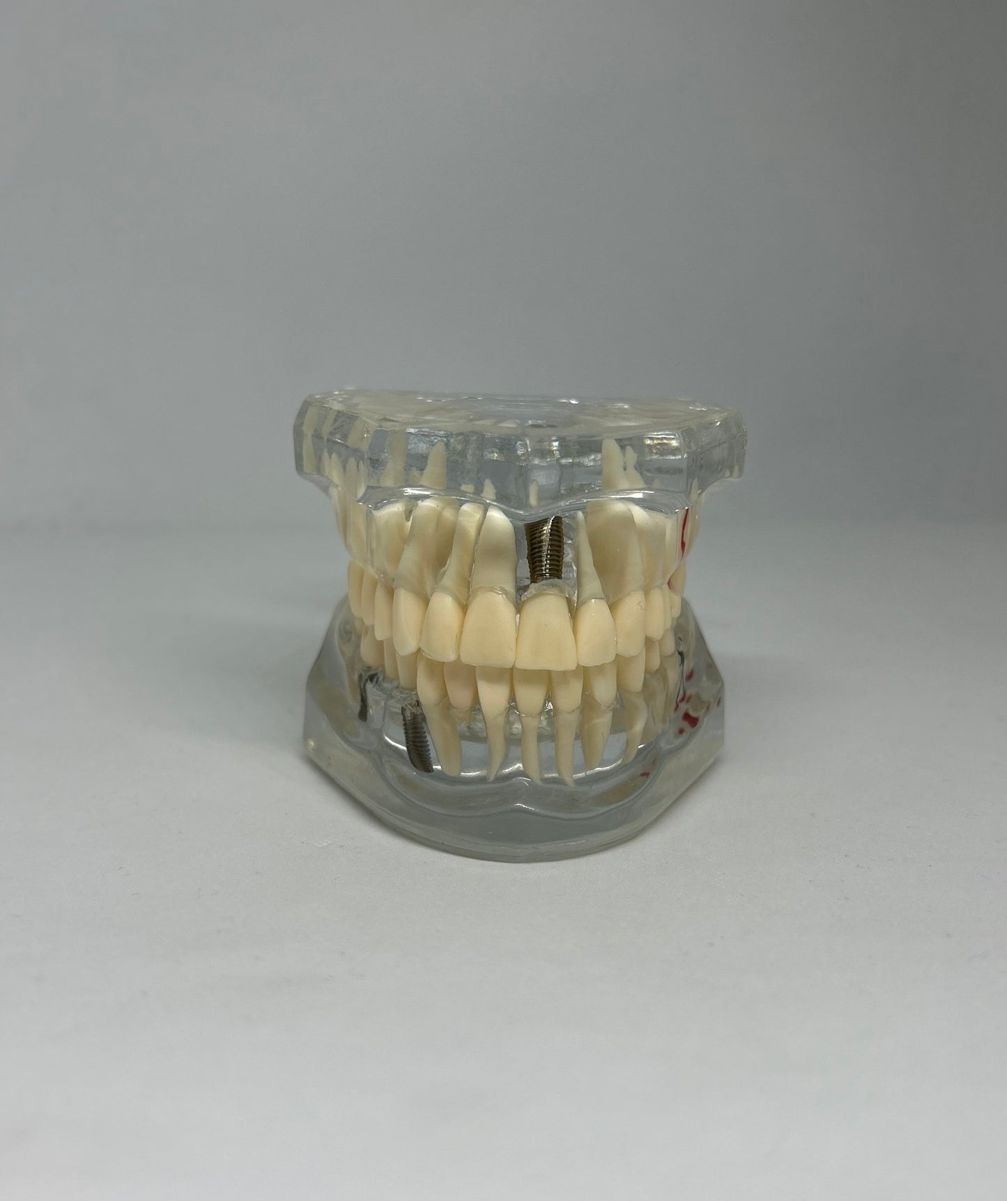 Implant model