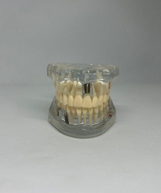 Implant model