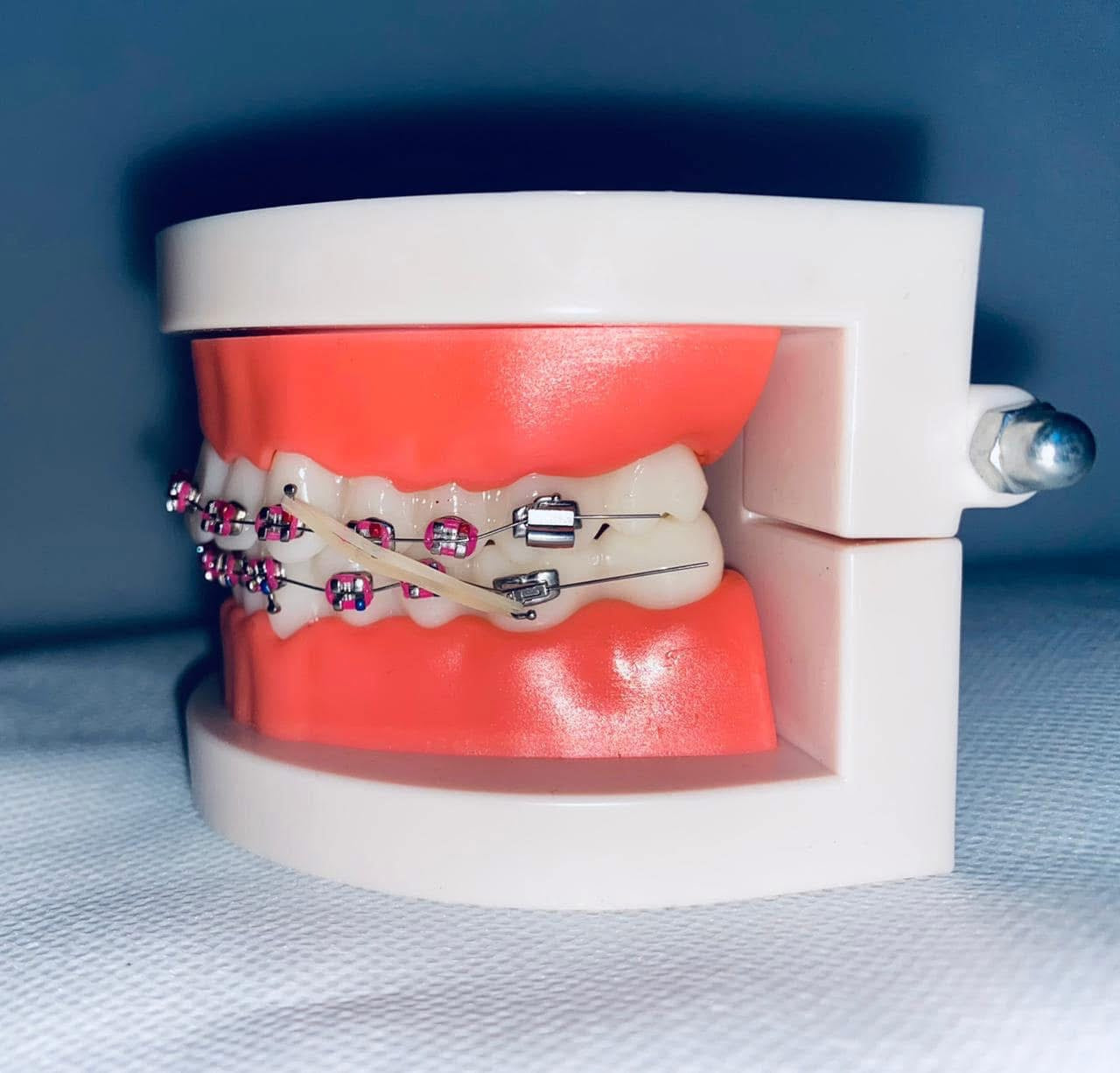 Ortho model