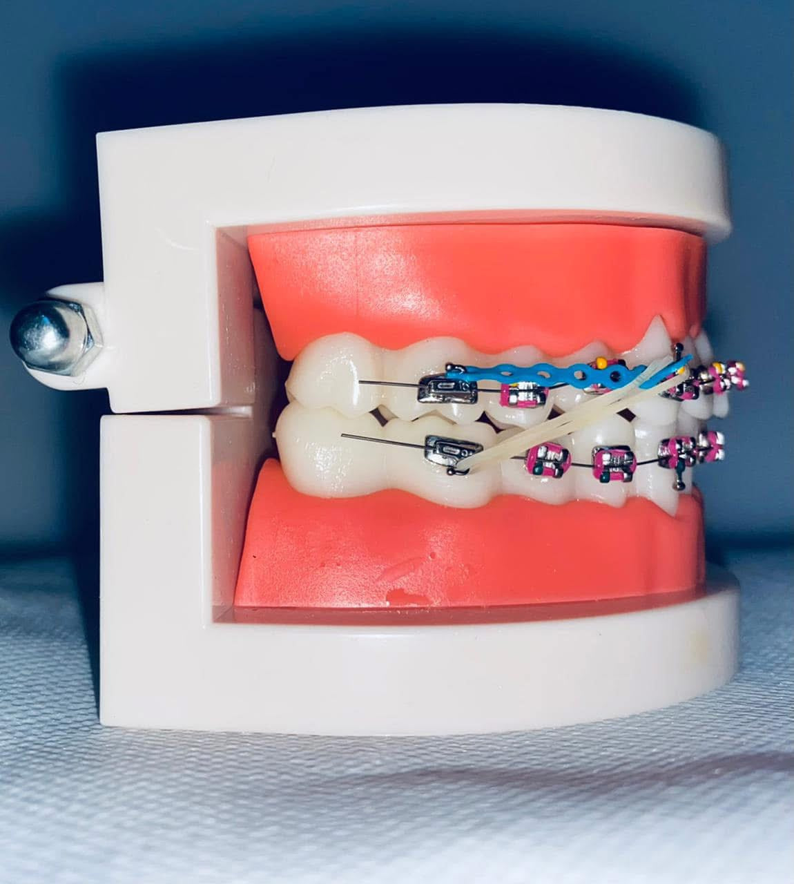 Ortho model