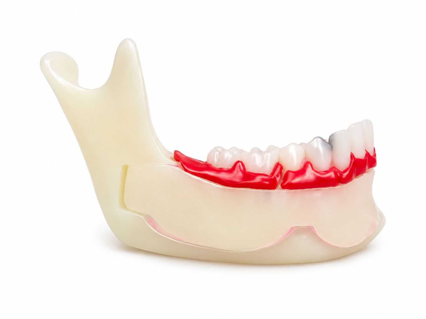 Half jaw model