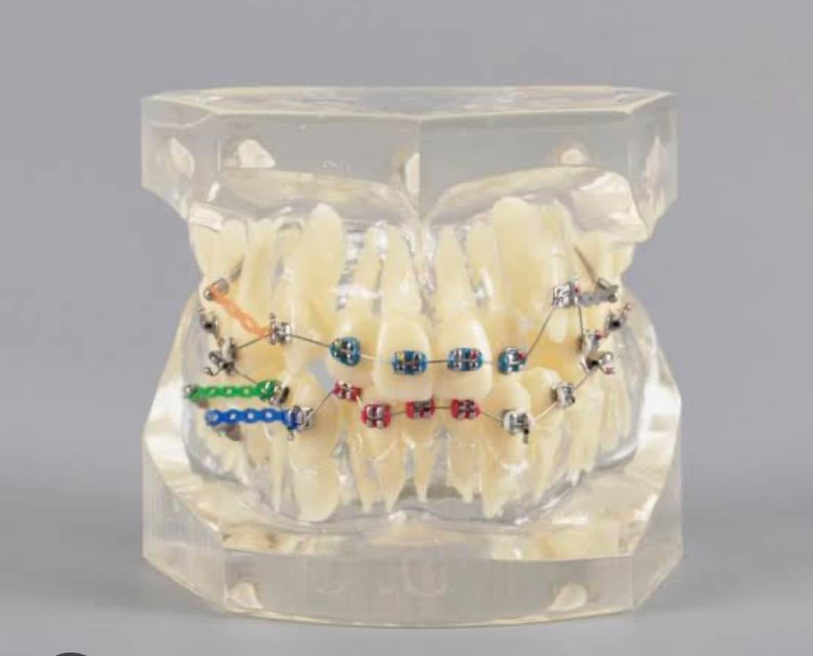 Dental models