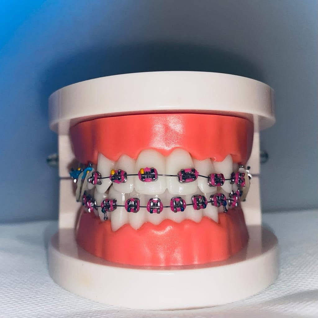 Ortho model