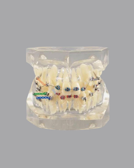 Orthodontic model