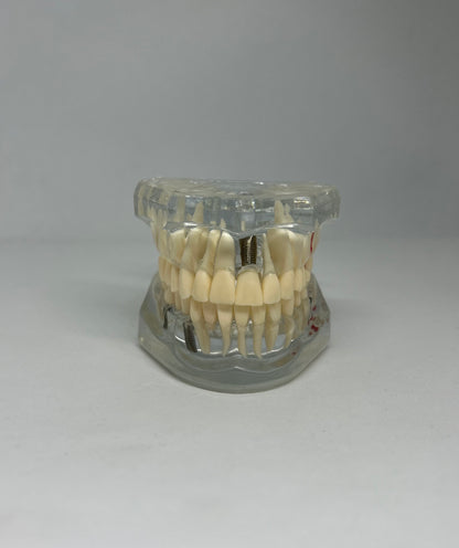 Implant model