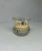 Implant model
