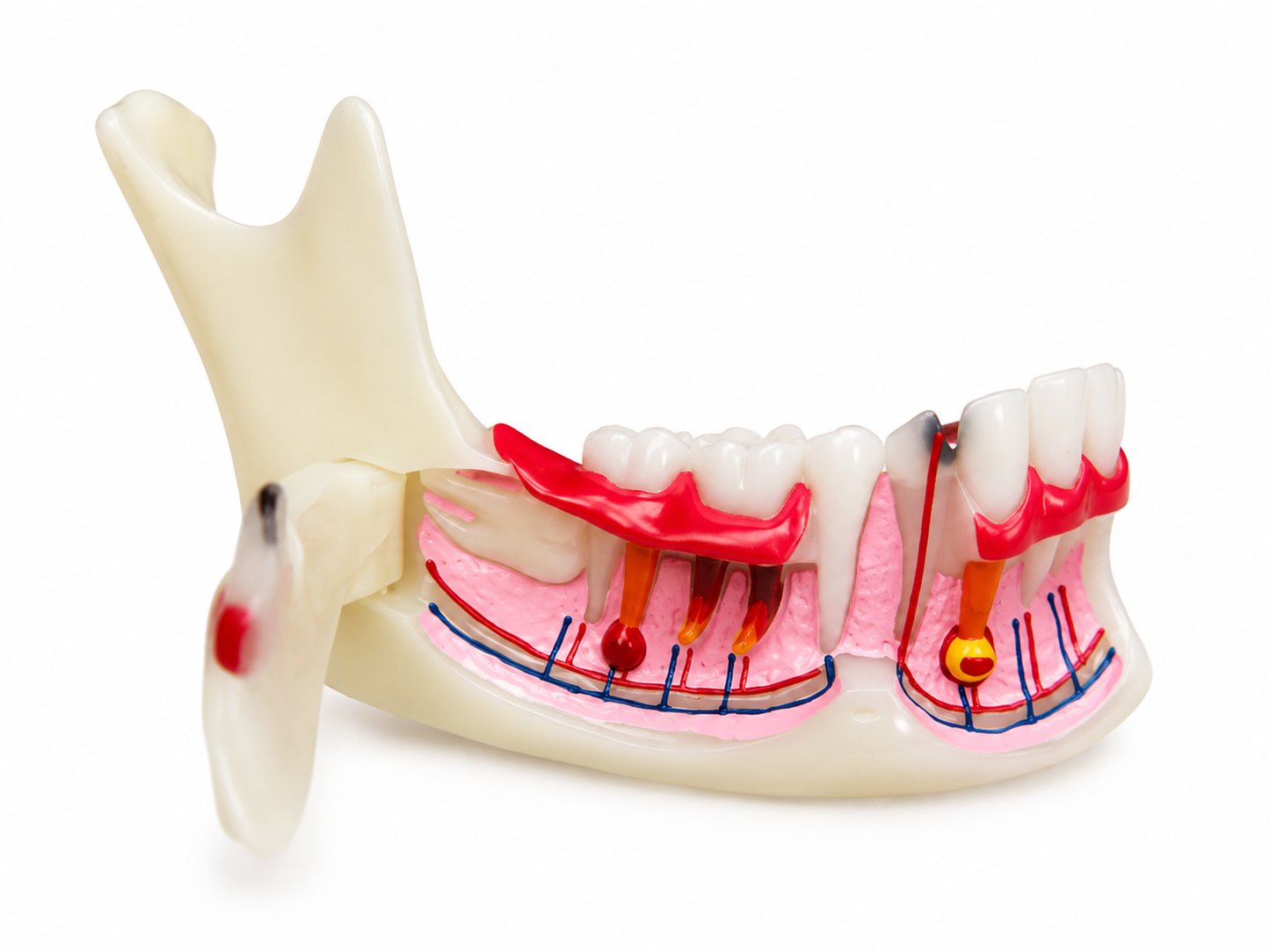 Half jaw model